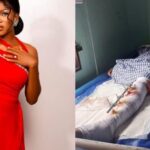 ‎Nigerian Female Graduate Loses Leg In Dangote Truck Accident As Family Accuses Police Of Cover Up, Seeks Justice.