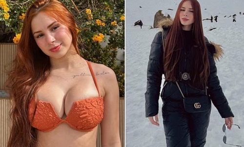 Influencer-des-@-22-weeks-after-getting-bre.ast-reduction-surgery